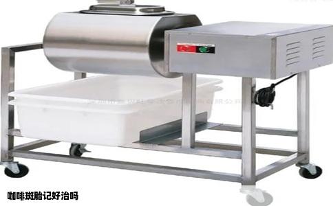 咖啡斑胎记好治吗